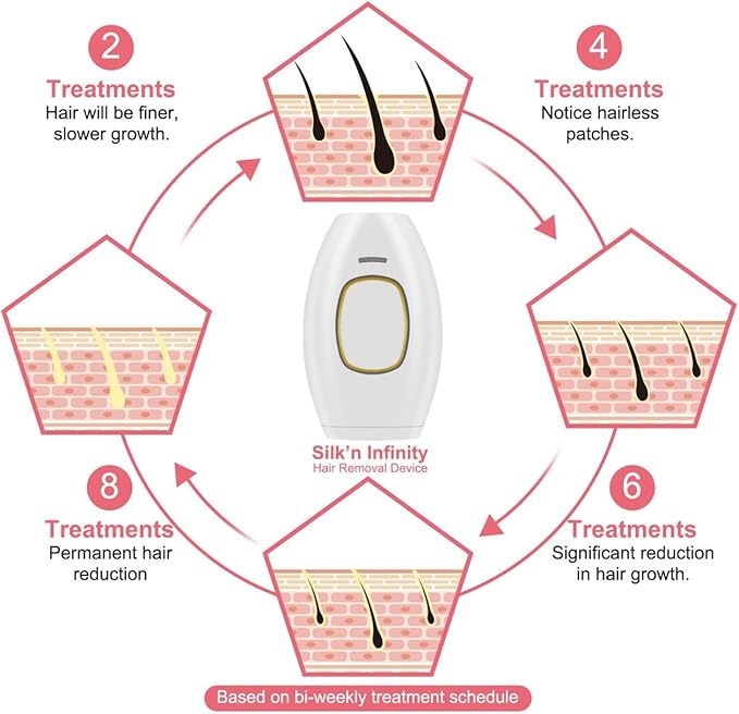 Home IPL Hair Removal Device – Professional Permanent Hair Reduction – Image 8