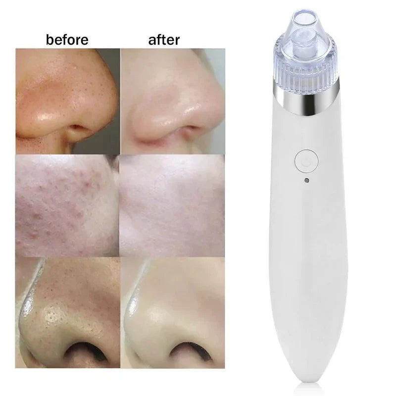 Electric Blackhead Remover Vacuum Suction Machine Rose Gold/Silver – Image 2